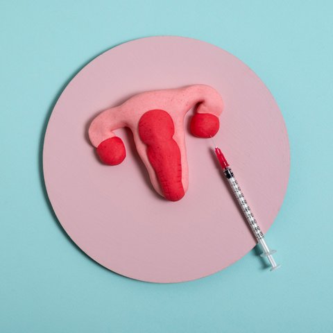 Jerawat Muncul Setelah Pasang IUD? Simak Penjelasan Ahli