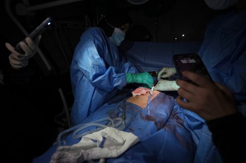 Dr. Abeer Al-Gharbawi melakukan operasi di bawah cahaya senter dua ponsel saat listrik padam di Rumah Sakit Shifa di Kota Gaza, Jumat, (04/07/2025).