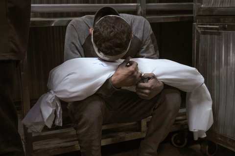 Seorang ayah memeluk jenazah anaknya, yang tewas akibat  serangan udara militer Israel di Rumah Sakit Shifa di Kota Gaza, Selasa, (15/07/2025).