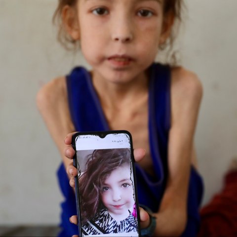 Gadis kecil asal Gaza, Rahaf Ayyad (12) menunjukkan foto dirinya sebelum kondisinya mulai memburuk.