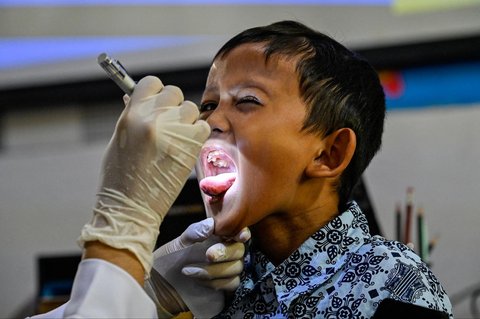 Petugas Pusat Kesehatan Masyarakat (Puskesmas) memeriksa kesehatan murid saat kegiatan Cek Kesehatan Gratis (CKG) di sekolah Madrasah Ibtidaiyah Negeri 6 Banda Aceh, Aceh, Rabu (23/07/2025).