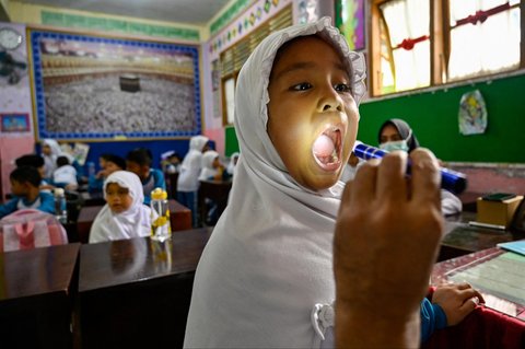 Petugas Pusat Kesehatan Masyarakat (Puskesmas) memeriksa kesehatan murid saat kegiatan Cek Kesehatan Gratis (CKG) di sekolah Madrasah Ibtidaiyah Negeri 6 Banda Aceh, Aceh, Rabu (23/07/2025).