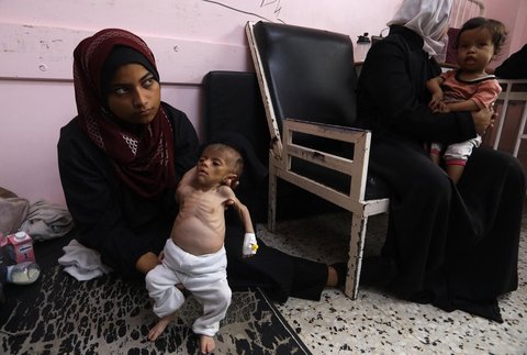 Yasmine, seorang ibu Palestina (22 tahun)  menggendong putrinya yang berusia 2 bulan, Teen, yang kekurangan gizi, saat menunggu perawatan di Rumah Sakit Nasser di Khan Yunis, Jalur Gaza selatan, Kamis (24/07/2025).