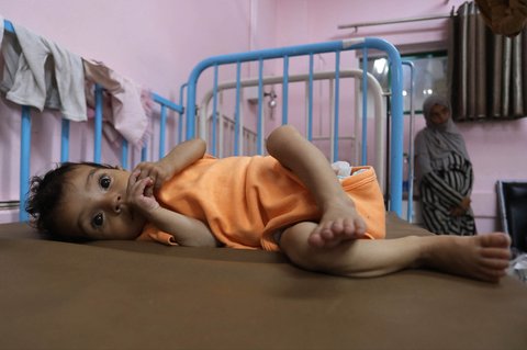 Rama bayi perempuan Palestina berusia 4 bulan yang kekurangan gizi terbaring di tempat tidur di Rumah Sakit Nasser di Khan Yunis, Jalur Gaza selatan, Kamis (24/07/2025).