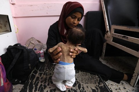 Yasmine, seorang ibu Palestina (22 tahun)  menggendong putrinya yang berusia 2 bulan, Teen, yang kekurangan gizi, saat menunggu perawatan di Rumah Sakit Nasser di Khan Yunis, Jalur Gaza selatan, Kamis (24/07/2025).