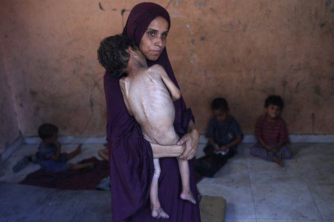 Naeema, seorang ibu Palestina (30 tahun) menggendong putranya yang berusia 2 tahun, Yazan, yang kekurangan gizi, saat mereka berdiri di rumah mereka yang hancur di kamp pengungsi Al-Shati, sebelah barat Kota Gaza, Rabu (23/07/2025).