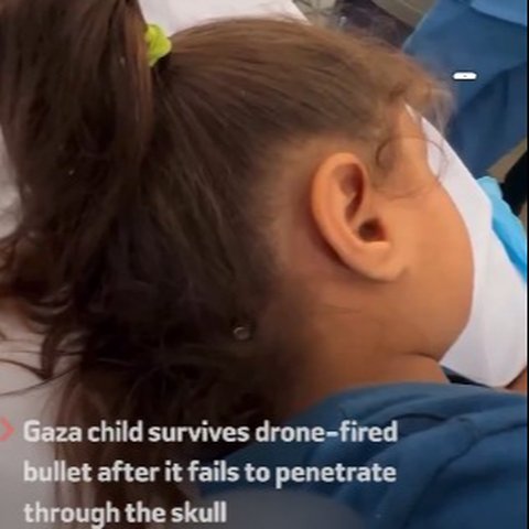 Anak perempuan Gaza selamat dari peluru israel