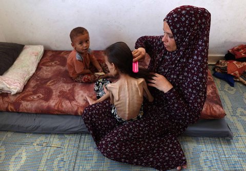 Mariam Dawwas, gadis Palestina berusia sembilan tahun yang kekurangan gizi, digendong oleh ibunya di lingkungan Rimal di Kota Gaza, Sabtu (02/08/2025).  Organisasi Kesehatan Dunia (WHO) memperingatkan pada 27 Juli bahwa malnutrisi telah mencapai