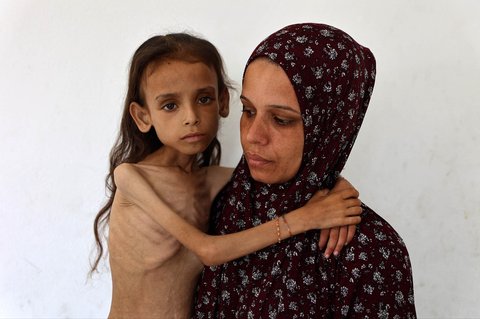 Mariam Dawwas, gadis Palestina berusia sembilan tahun yang kekurangan gizi, digendong oleh ibunya di lingkungan Rimal di Kota Gaza, Sabtu (02/08/2025).  Organisasi Kesehatan Dunia (WHO) memperingatkan pada 27 Juli bahwa malnutrisi telah mencapai