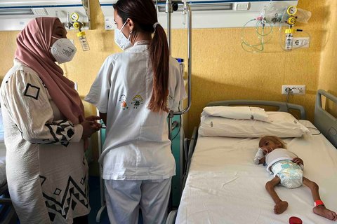Balita Gaza  bernama Shamm Qudeih yang menderita malnutrisi dirawat di Rumah Sakit Anak Santobono Pausilipon di Naples, Italia Selatan  (14/08/2025).