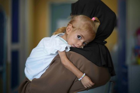 Balita Gaza Shamm Qudeih di Rumah Sakit Anak Santobono Pausilipon di Naples, Italia selatan, Selasa (02/09/2025)