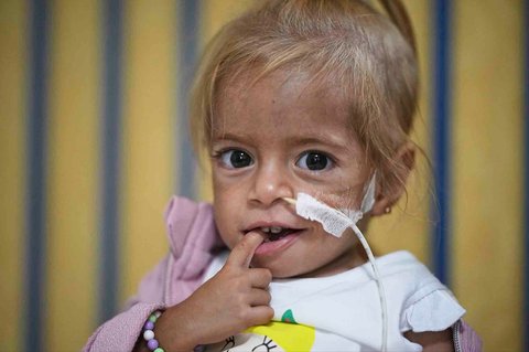 Balita Gaza Shamm Qudeih di Rumah Sakit Anak Santobono Pausilipon di Naples, Italia selatan, Selasa (02/09/2025)