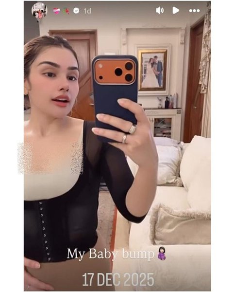 Kabar Nourah Sheivirah istri Teuku Rafly keguguran calon anak keempat. [IG: @nourahsheivirah]