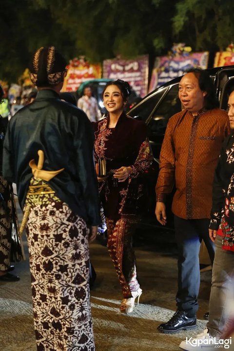 Kondisi Tio Pakusadewo Membaik, Dewi Perssik Berharap Bisa Main Film Bareng