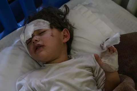 Menisa Taha asal Suriah, yang terluka dalam serangan udara Israel, terbaring di Rumah Sakit Rayak di Lebanon timur, Sabtu, (21/02/2026).