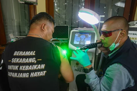 Petugas menghapus tato pada tubuh peserta menggunakan laser di Masjid Sunda Kelapa, Jakarta, Selasa (24/02/2026).