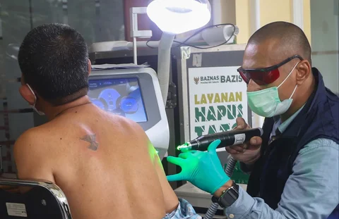 Petugas menghapus tato pada tubuh peserta menggunakan laser di Masjid Sunda Kelapa, Jakarta, Selasa (24/02/2026).