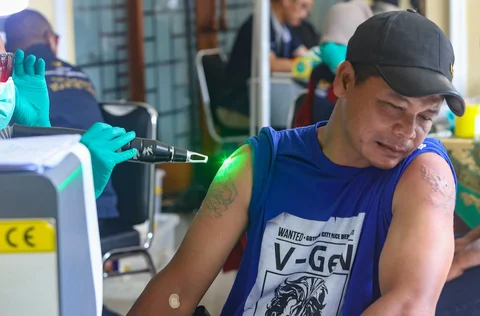 Petugas menghapus tato pada tubuh peserta menggunakan laser di Masjid Sunda Kelapa, Jakarta, Selasa (24/02/2026).