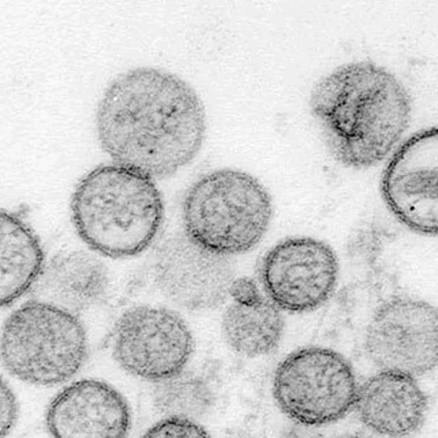 Ilustrasi virus hanta. (Source:AP)