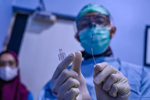 Seorang dokter ahli bedah menunjukkan stent jantung selama operasi di rumah sakit Meuraxa di Banda Aceh, Kamis (11/06/2026).