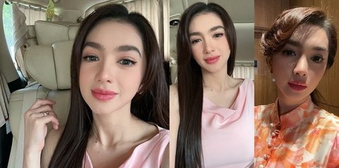 Angel Karamoy Dipuji Semakin Cantik Setelah Operasi Plastik di Korea, Dengan Bentuk Hidung yang Terlihat Berbeda