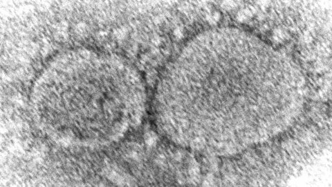 CIA Ungkap Kemungkinan Besar Covid-19 Berasal dari Kebocoran Laboratorium di Wuhan