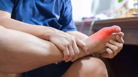 Cara Efektif Mengurangi Bengkak di Kaki akibat Asam Urat, Bisa Pakai Es Batu