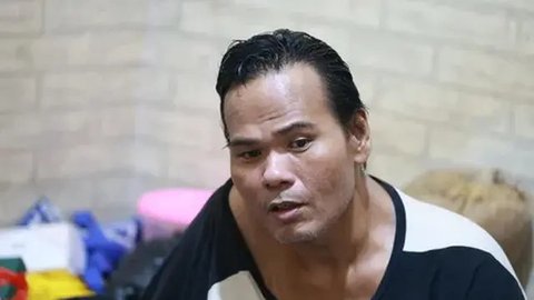 Kabar Terbaru Fahmi Bo Hidup Sebatang Kara dengan Penyakit Komplikasi, Tak Bisa Berjalan dan Harus Segera Dioperasi