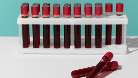 Jerman Krisis Darah, Bagaimana Nasib Pasien di Rumah Sakit?