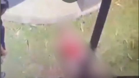 Kondisi Terkini Bocah yang Alami Koma Usai Kesetrum Akibat Dibully
