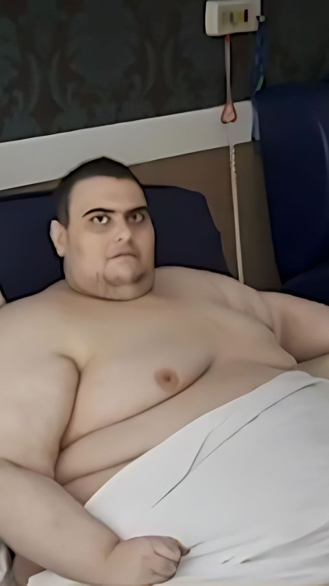 Hobby of Eating Makes This Young Man Obese with a Weight of Almost 300 Kg, Now Begging to be Injected with Magical Weight Loss Medicine