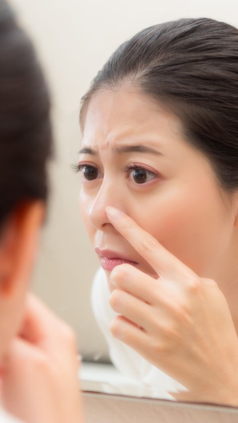 White Spots on the Nose Doesn't Necessarily Mean Blackheads, Could Be Sebaceous Filaments