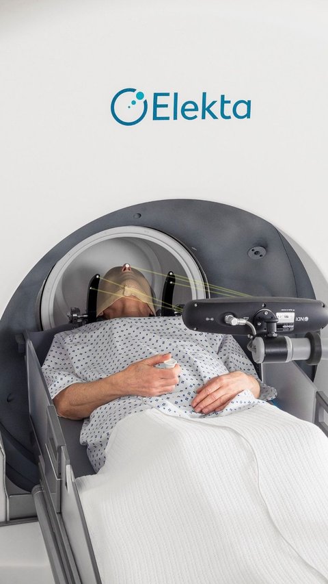 Getting to Know Gamma Knife Surgery, Non-Surgical Treatment for Brain Tumors