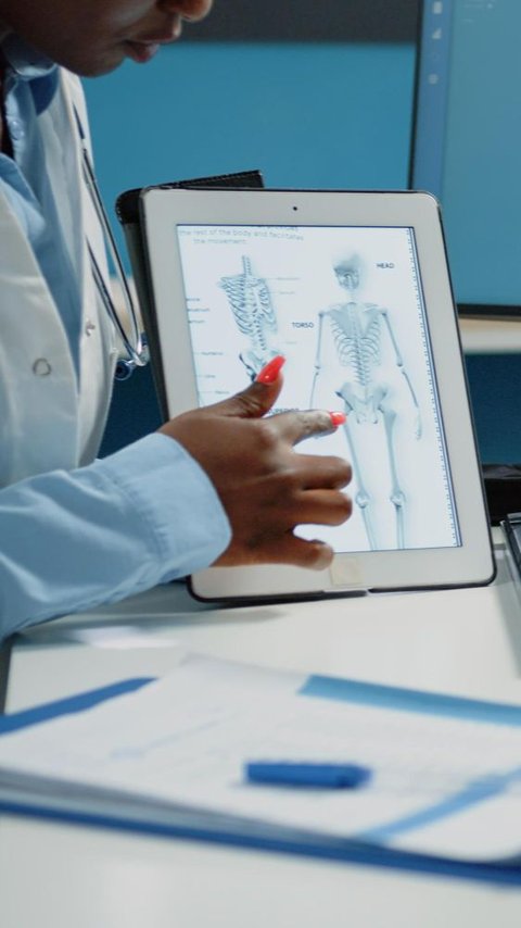 Cara Mencegah Osteoporosis Sejak Usia Muda, Jangan Tunda Nanti