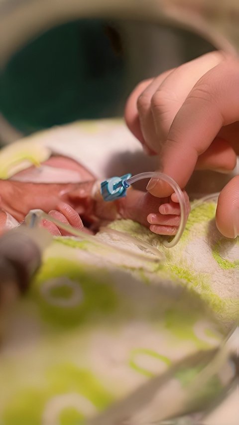 Bayi Prematur di Tasikmalaya Meninggal Usai Dijadikan Konten, Begini Penjelasan Dokter Anak