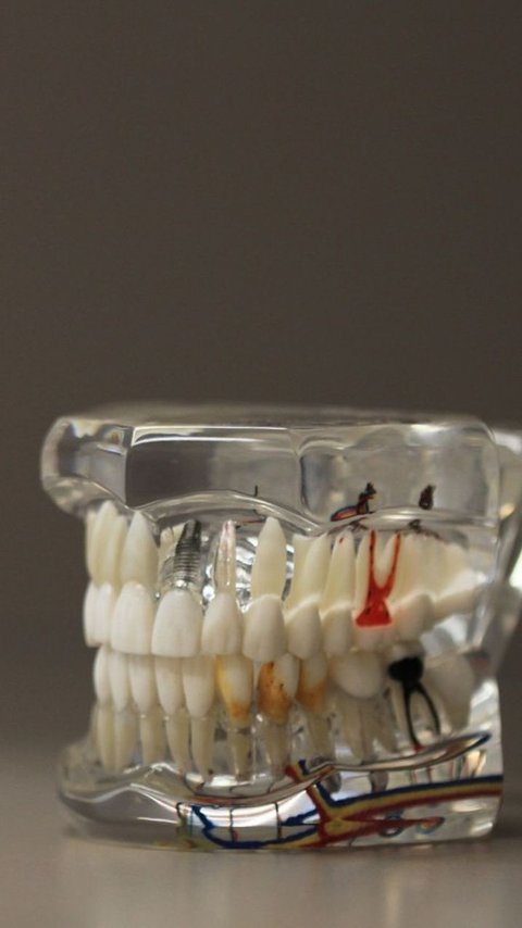 Ilmuwan Temukan Solusi Tumbuhkan Gigi untuk Orang Dewasa, Begini Caranya
