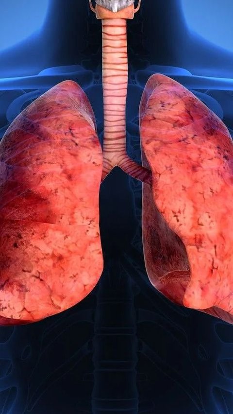 Perbedaan Paru-paru Perokok dan Bukan Perokok, Ketahui Ciri-cirinya