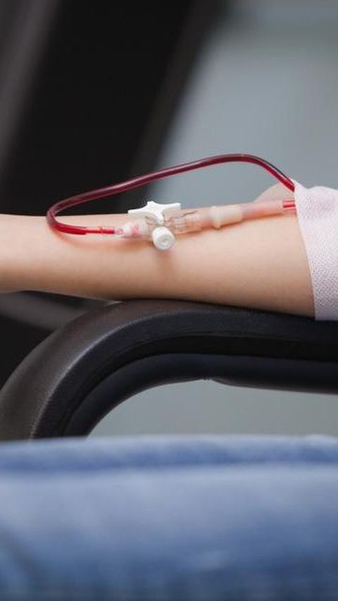 Cuci Darah dengan Metode Single Use Dyalizer Dinilai Lebih Aman dan Nyaman