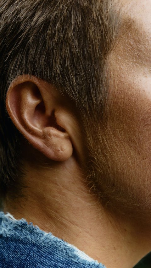 6 Cara Mencegah Masalah Pendengaran ketika Berada di Lingkungan Sangat Bising