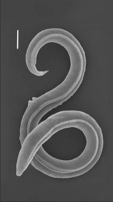 Scientists Bring 46,000-Year-Old Ancient Worms Back Life