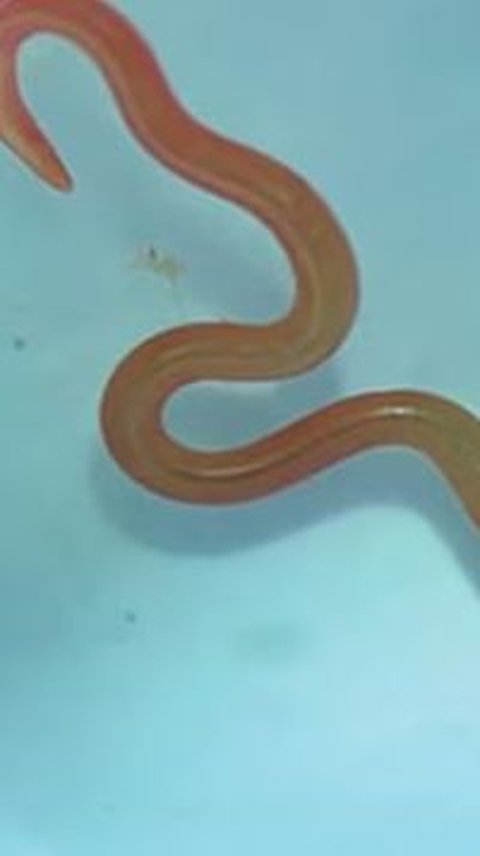 Live Worm Found in Australian Woman's Brain, First Case in the World