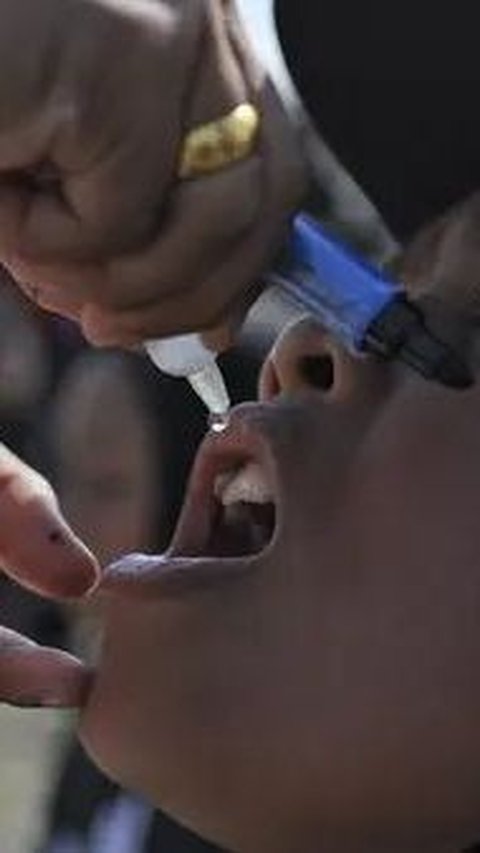 Kondisi Terkini Anak Kena Polio di Klaten