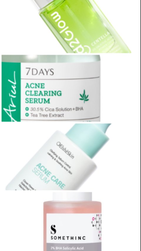 7 Serum Terbaik untuk Kulit Berjerawat yang Viral di 2024, Wajib Coba Untuk Team Acne-Prone!