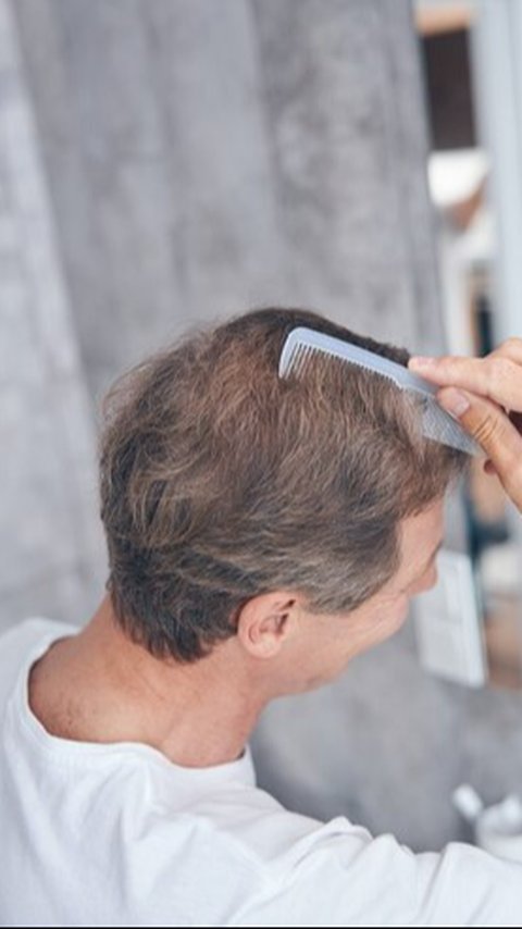 10 Ways to Nourish Thinning Hair in Men