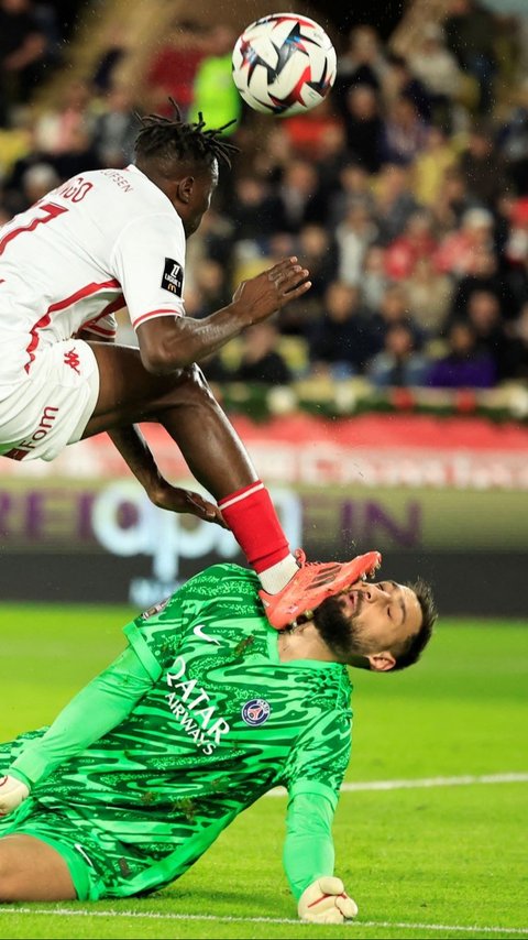 FOTO: Ngeri! Begini Kondisi Wajah Donnarumma Berdarah-darah Usai Tendangan Horor Wilfried Singo