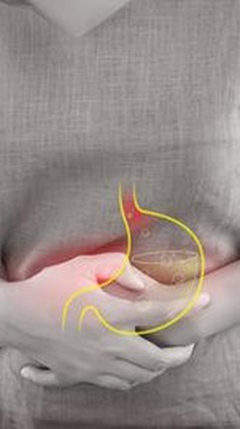Ciri-ciri Penderita Asam Lambung, Gejala Umum dan Cara Efektif Mengatasinya