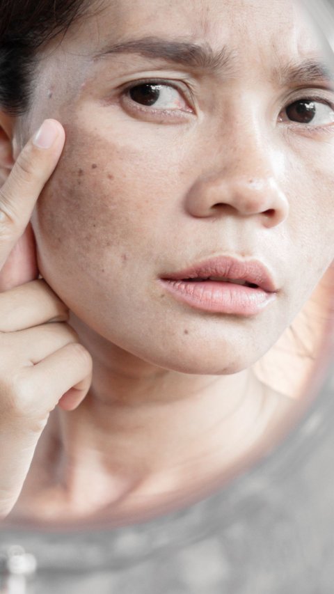 2 Powerful Skincare Ingredients to Fade Dark Spots