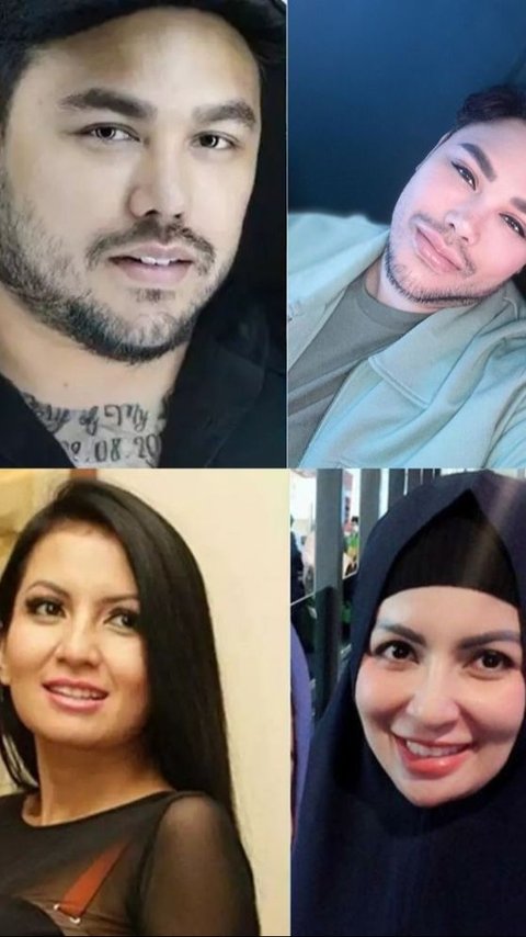 10 Potret Artis Sebelum-Sesudah Filler Bibir, dari Ivan Gunawan sampai Momo Eks Geisha