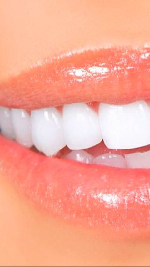 How to Whiten Yellow Teeth Effectively and Naturally, Just Use These 2 Ingredients