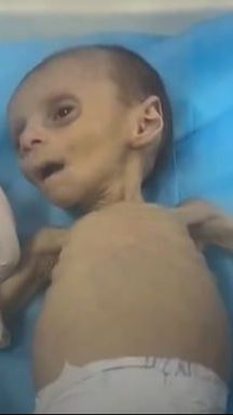 VIDEO Bayi 2 Bulan di Gaza Sekarat karena Kelaparan Akibat Blokade Israel Larang Masuk Bantuan Makanan